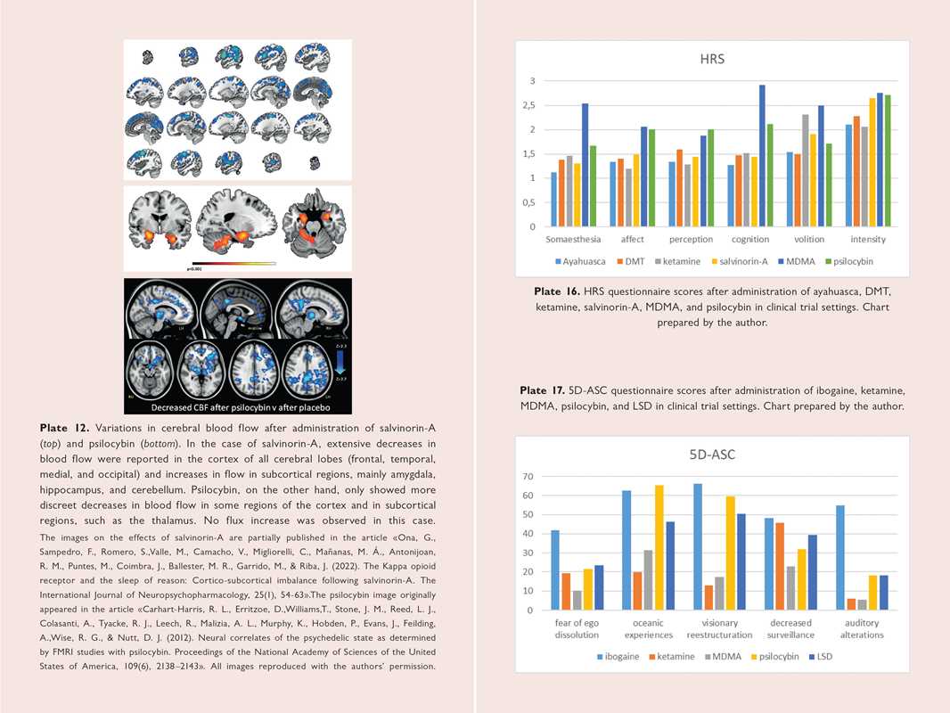 Neuroscience of Psychedelics by Genís Ona