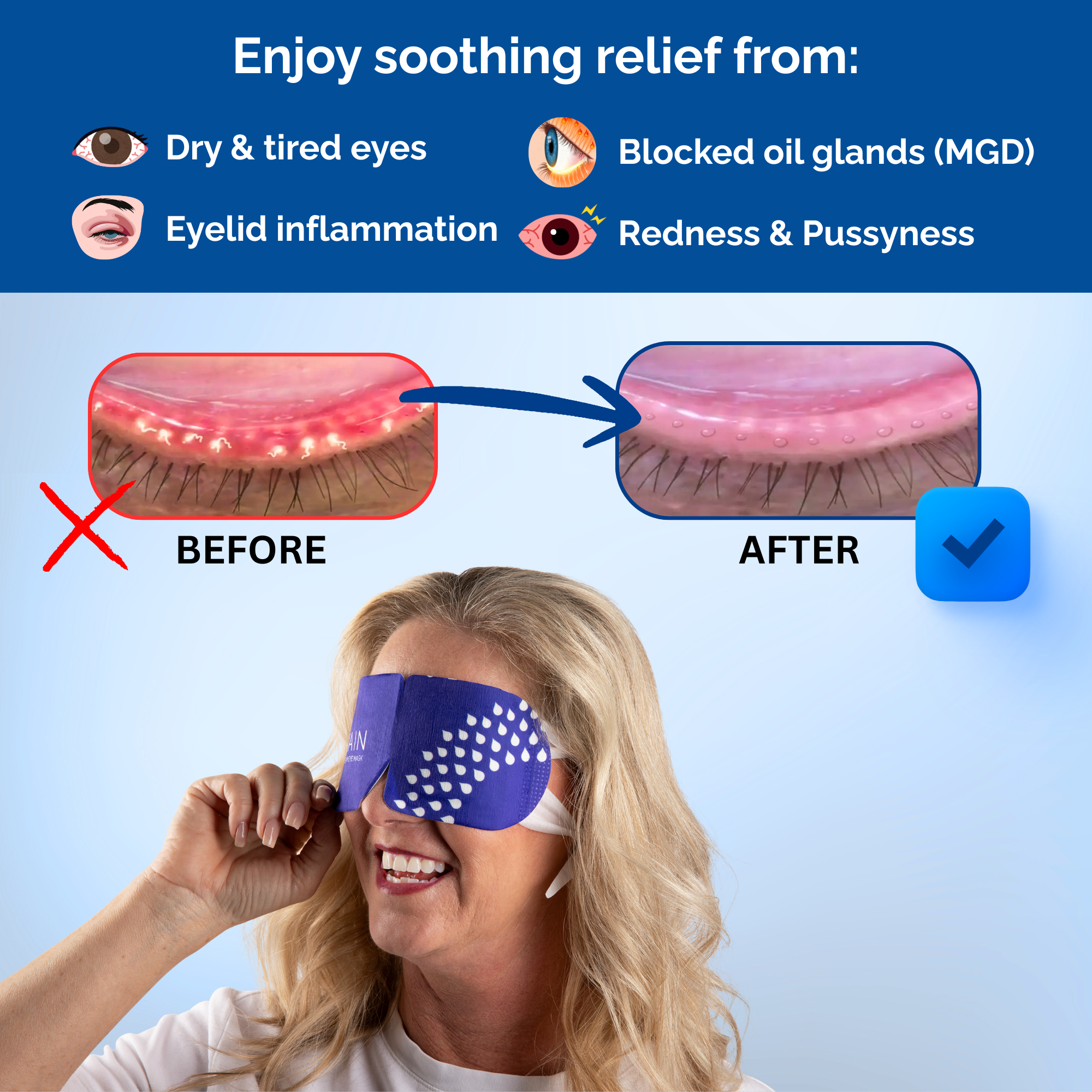 Rain Self-heating Warm Compress Eye Masks, 20 count